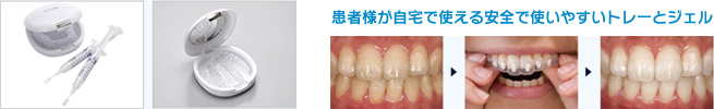 ホームホワイトニングイメージ